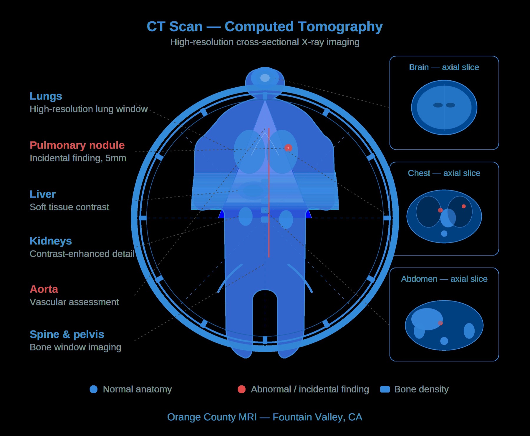 CT scan machine