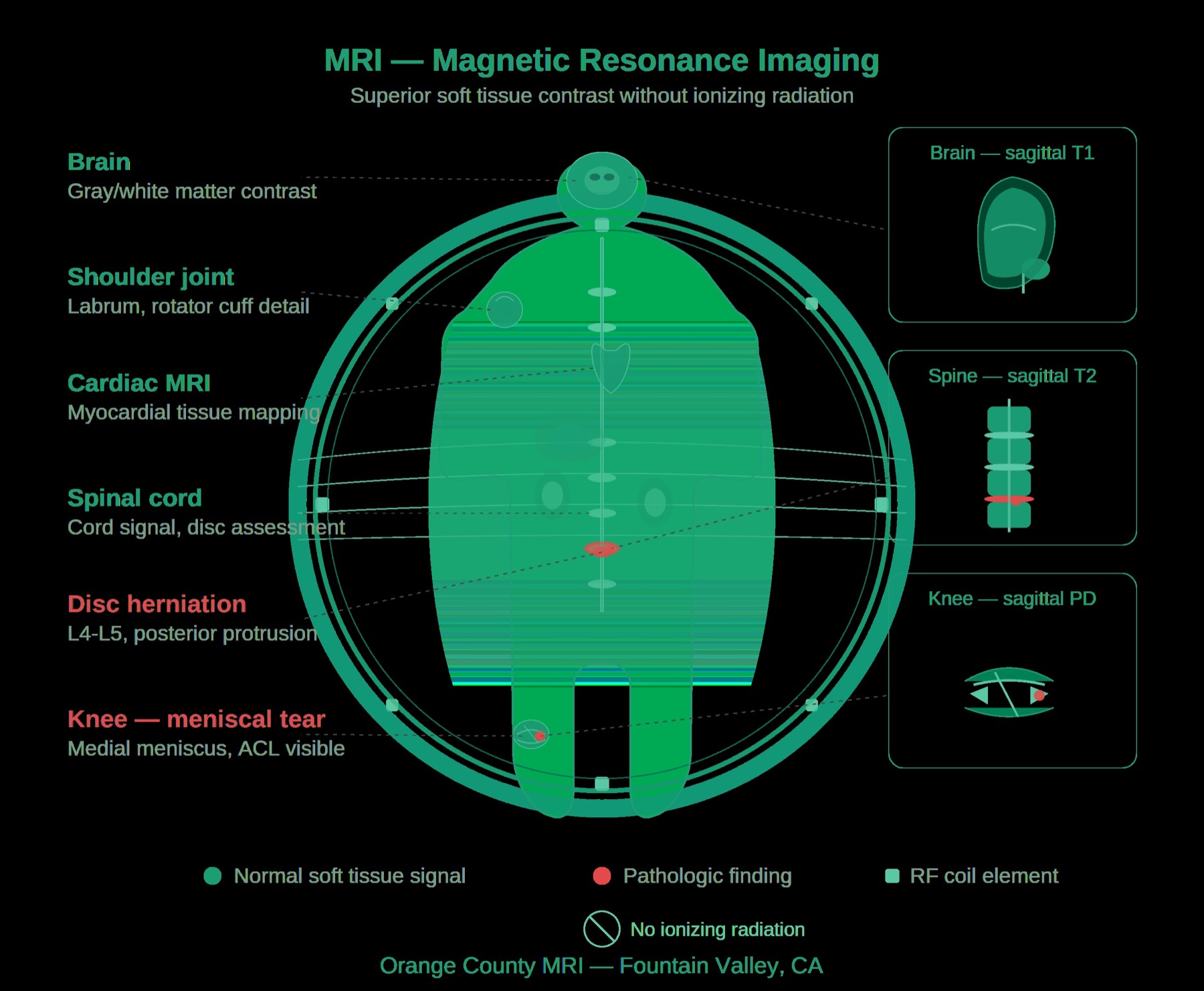 MRI scan equipment