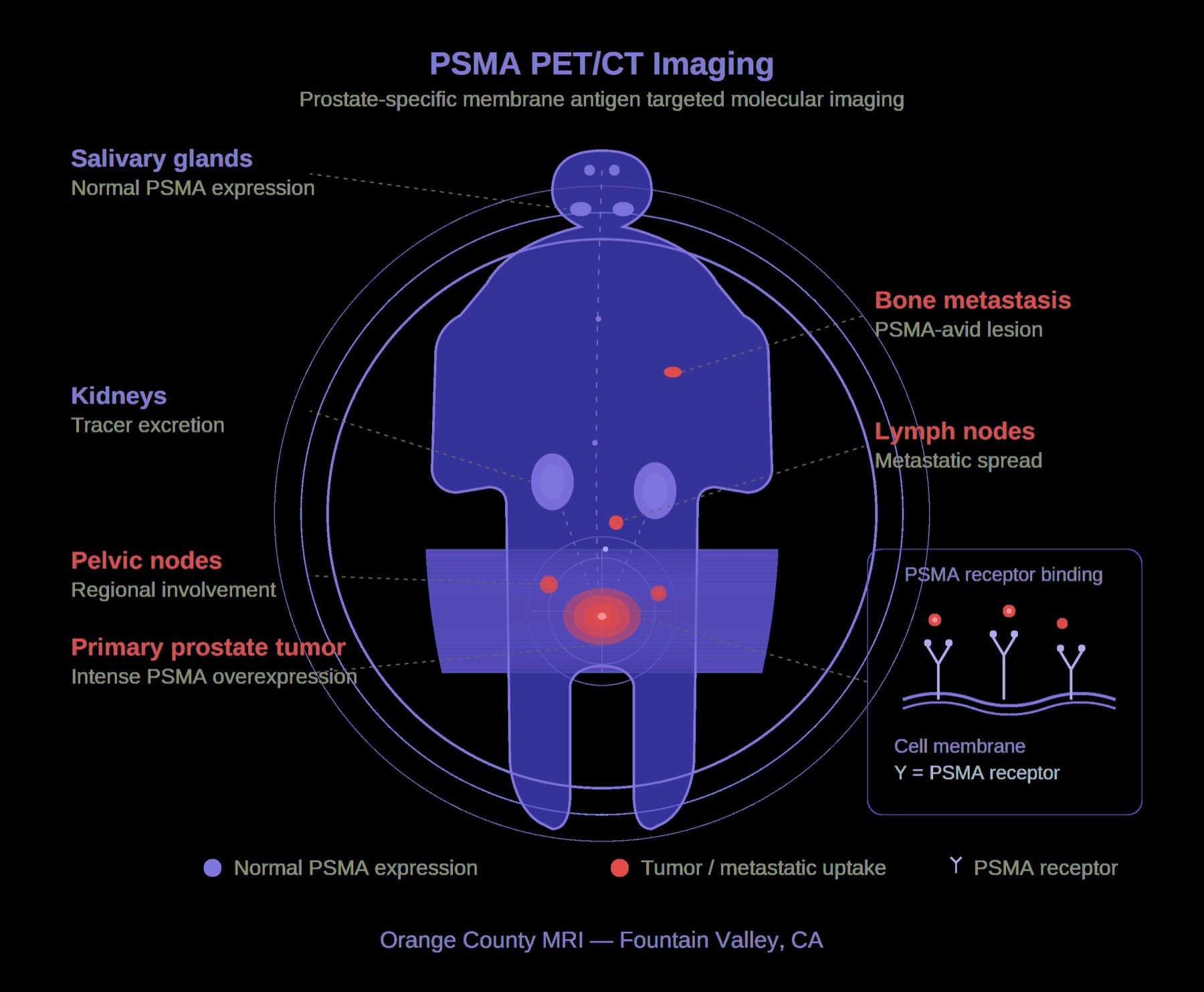 PSMA PET CT study